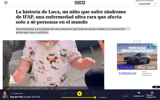 La historia de Luca, un niño que sufre síndrome de IFAP, una enfermedad ultra rara que afecta solo a 40 personas en el mundo